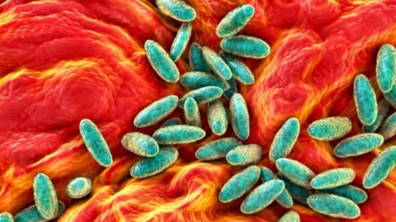 Russia Plague Scare: Lab Worker Dies as Nearly 200 Face Quarantine in Siberia