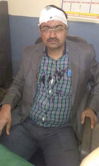 महराजगंजः अस्पताल में सीनियर डॉक्टर को उपद्रवियों ने बुरी तरह पीटा.. खून से लथपथ देख कर्मियों के खड़े हुए रोंगटे