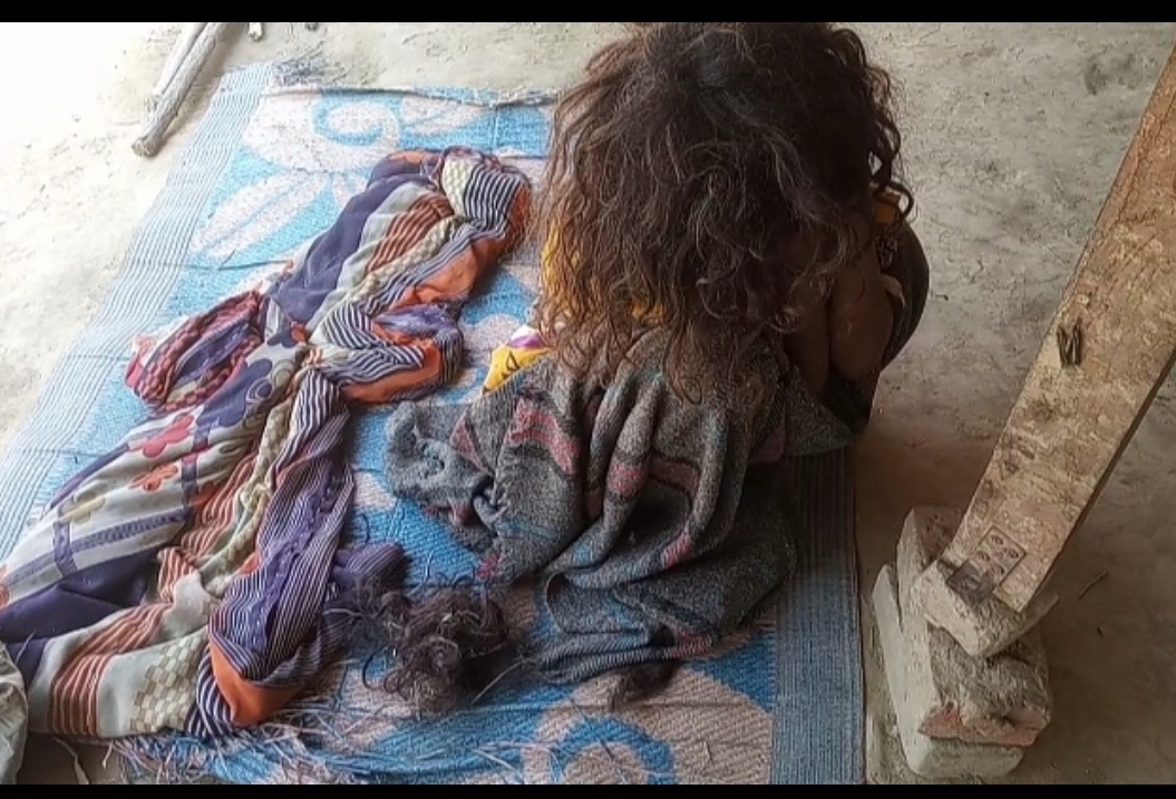 महराजगंज: चुड़ैल समझ महिला की जबरदस्त पिटाई, दबंगो ने बाल काट फेंका नाले में, पुलिस मौन