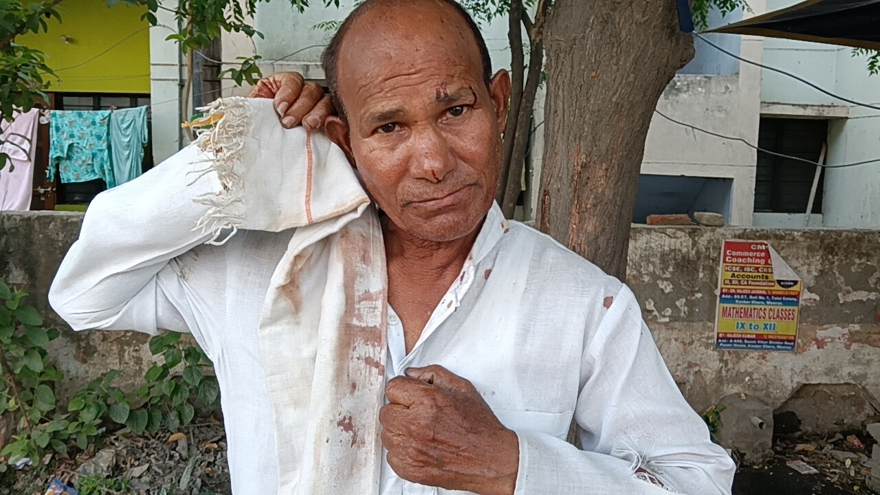 Meerut News: बुजुर्ग पर जानलेवा हमला, बंटी बना जानी दुश्मन, जानिए क्यों