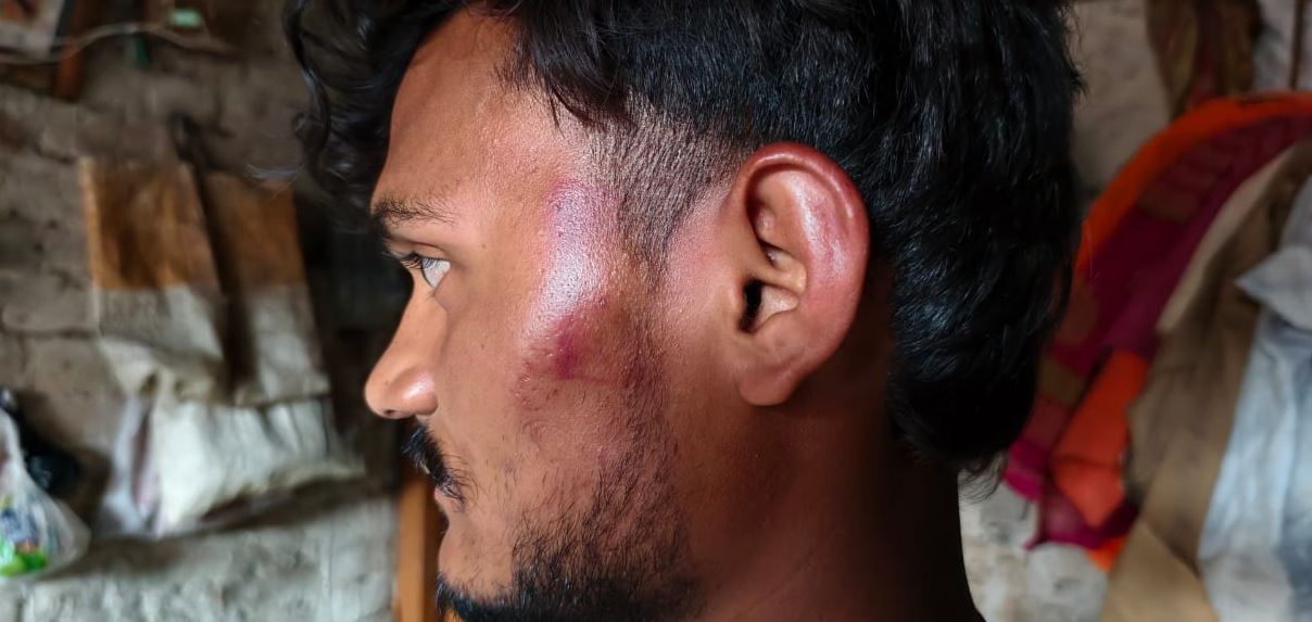 पनियरा में पाकिस्तान विरोधी स्टेटस लगाने पर युवक की पिटाई, गंभीर रूप से घायल