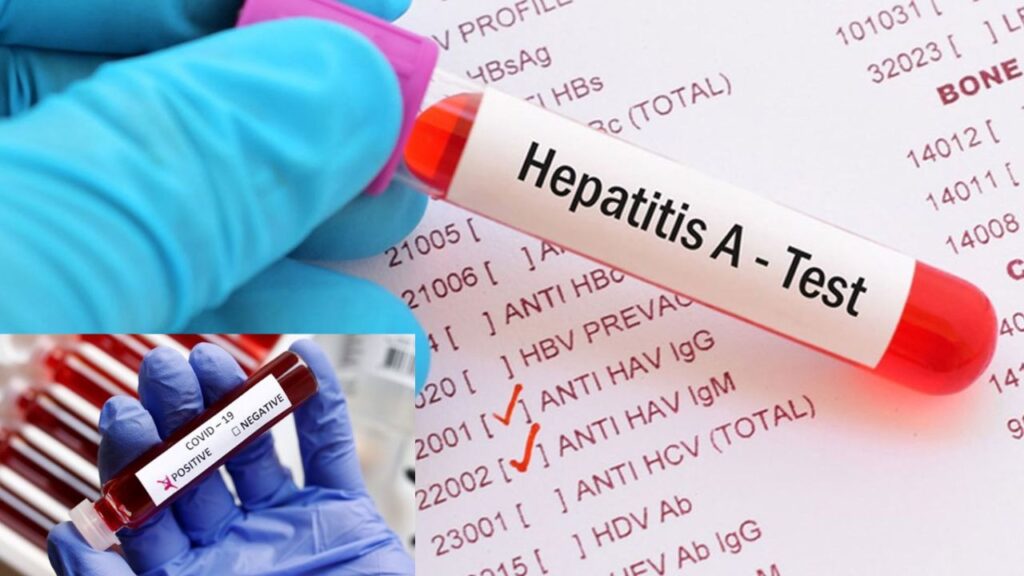 Hepatitis-A outbreak in Kerala