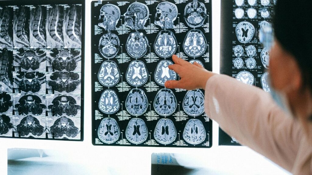 Brain infection increased in monsoon