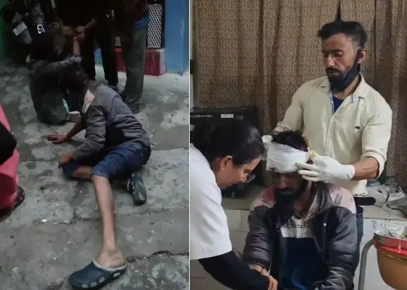 नशे में डूबा भाईचारा! छोटे भाई ने किया बड़े भाई पर जानलेवा हमला; नैनीताल में रिश्ता शर्मसार