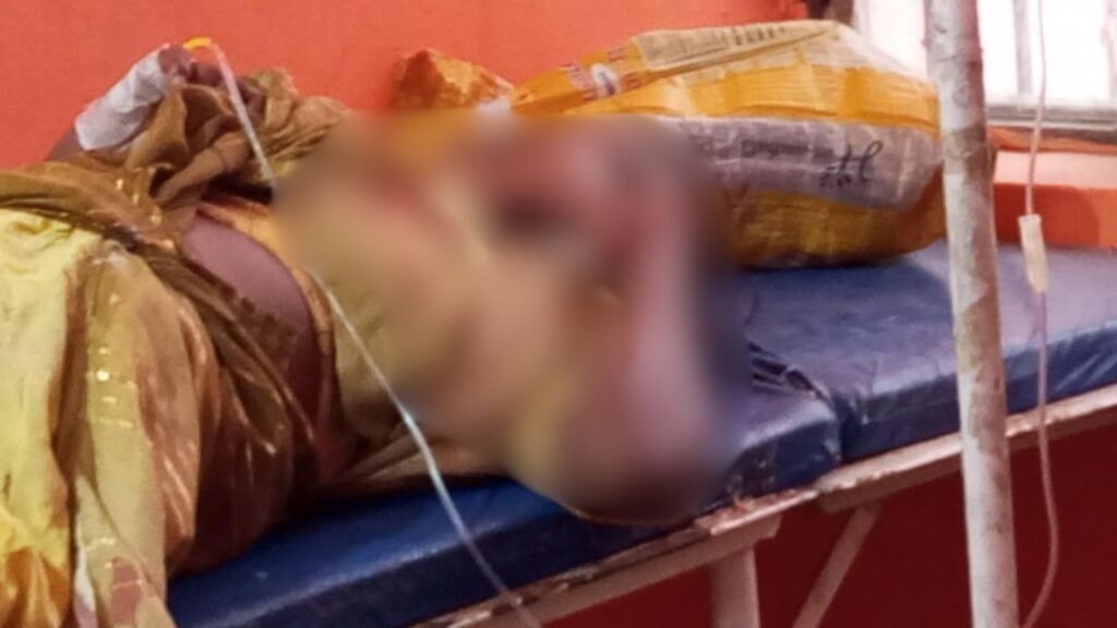 Injured Woman