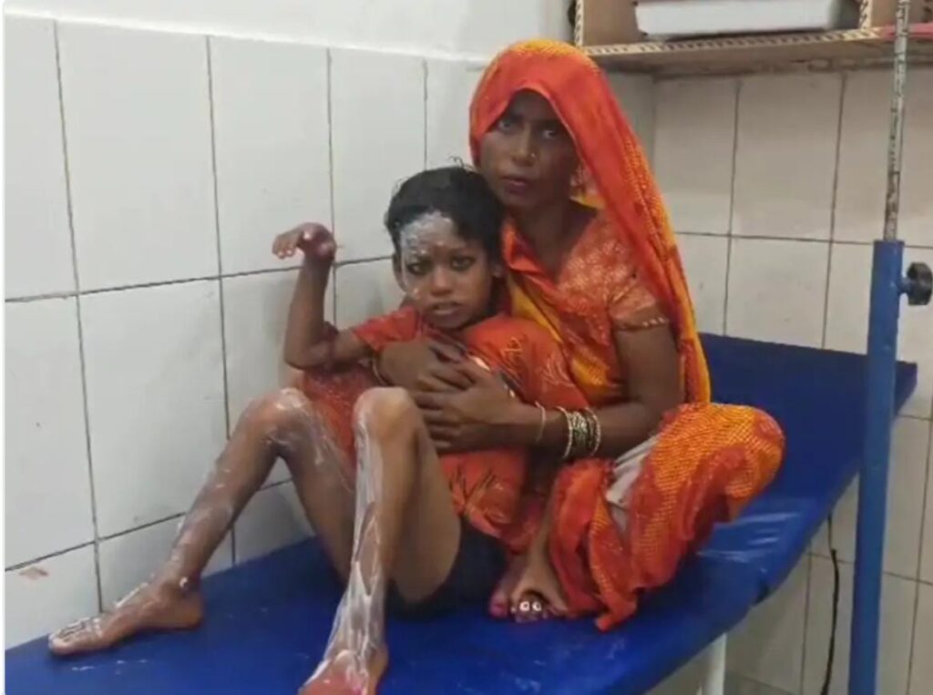 Fatehpur Fire News
