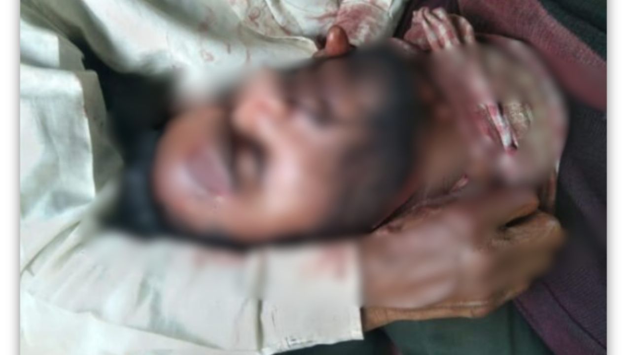 गोरखपुर: अवैध संबंध का खौफनाक अंत, पत्नी और प्रेमी ने मिलकर पति का गला रेतना चाहा; गंभीर हालत में जिला अस्पताल रेफर