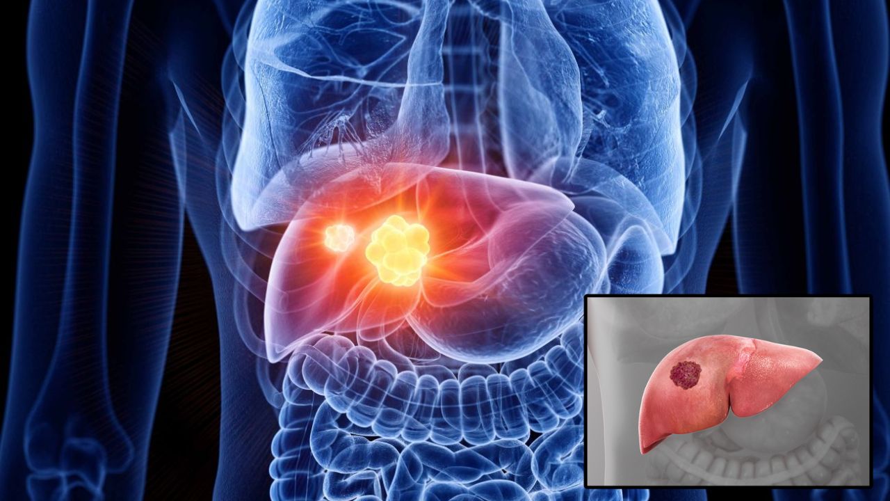 Lifestyle News: रोजमर्रा की कुछ आदतें कर सकती हैं लिवर को मजबूत, जानें कौन सी लाइफस्टाइल बदलनी है जरूरी