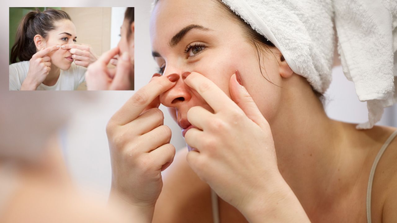 पिंपल्स और ऑयली स्किन से छुटकारा पाने के आसान उपाय, जानिए स्किन को साफ, हेल्दी और ग्लोइंग बनाने का सही तरीका