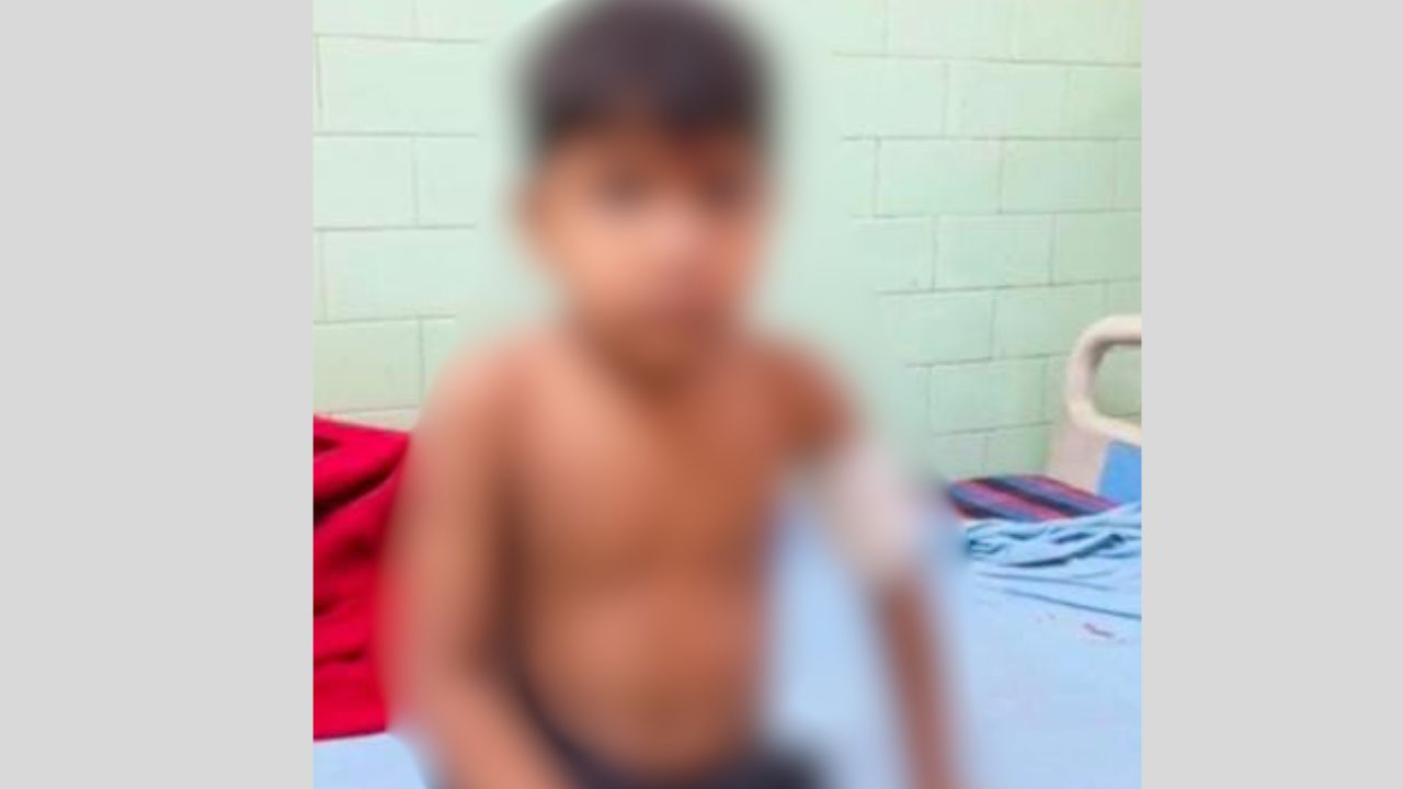 बरेली में आवारा कुत्तों का आतंक, घर के बाहर खेल रहे मासूम पर किया हमला, गंभीर