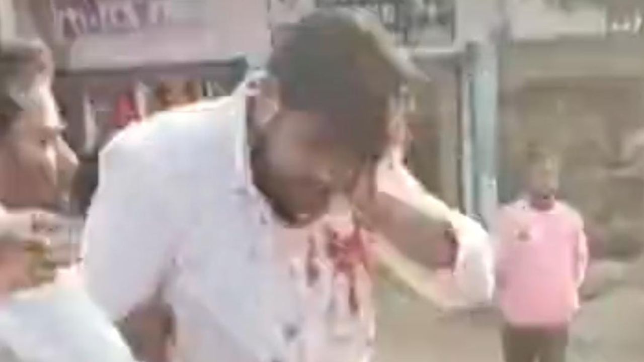 Maharajganj: नशे में धुत युवक ने झोलाछाप डॉक्टर पर किया धारदार हथियार से हमला, कान काटकर किया लहूलुहान