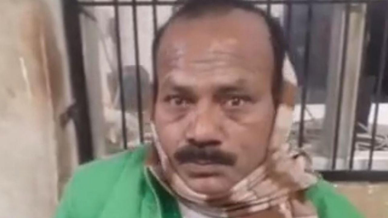 देवरिया में कोबरा को पकड़ना पड़ा भारी, सांप ने 50 से ज्यादा बार काटा