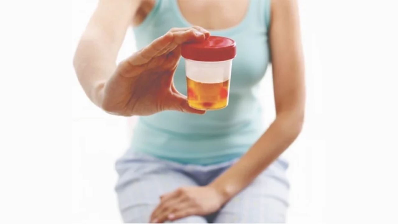 Urine में बल्ड जैसा रंग? हो सकता है गंभीर बीमारी का लक्षण; गलती से भी ना करें नजरअंदाज