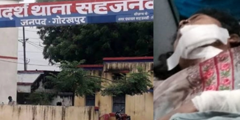 गोरखपुर में किशोरी पर चाकू से हमला, पुलिस ने हत्या के प्रयास पर किया मुकदमा दर्ज; जानें असल में क्या है मामला