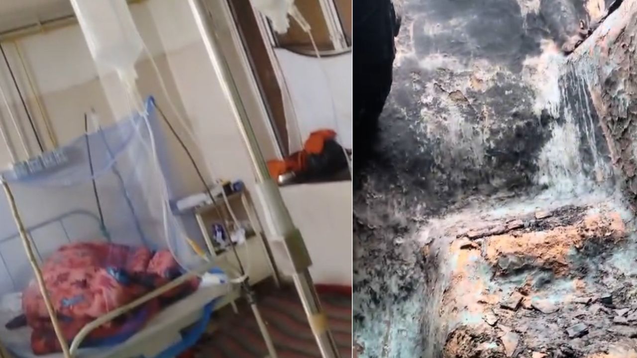 Sonbhadra: घर में लगी भीषण आग, युवक बुरी तरह से झुलसा, लाखों का माल खाक