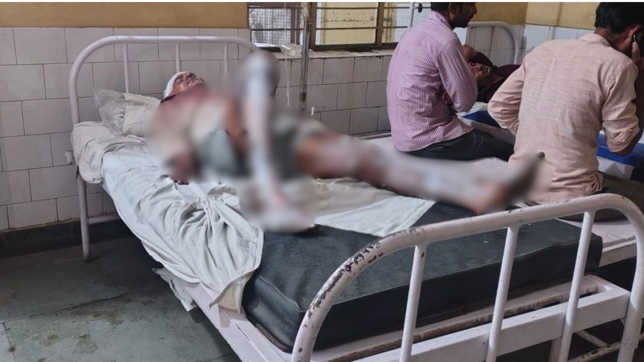 बदायूं में सनसनी: पहले लाठी से पीटा, फिर भाई पर उड़ेल दिया… जानें क्या है पूरा मामला