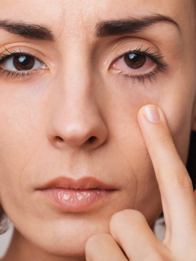 आंखों में जलन या लालिमा? जानिए कब लें डॉक्टर की मदद