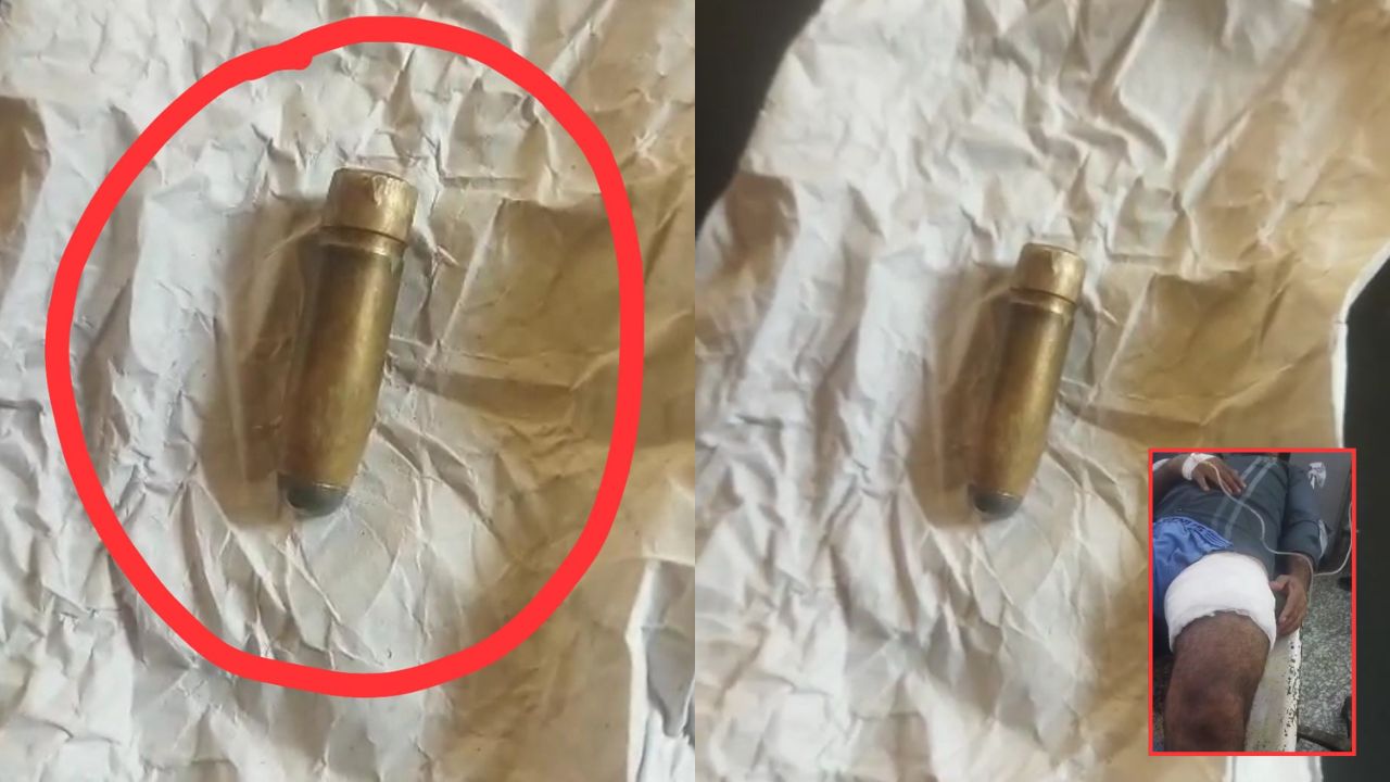 “फायरिंग नहीं हुई…” फिर घायल की जांघ में कहां से आई गोली? महराजगंज पुलिस के दावे पर सवाल!