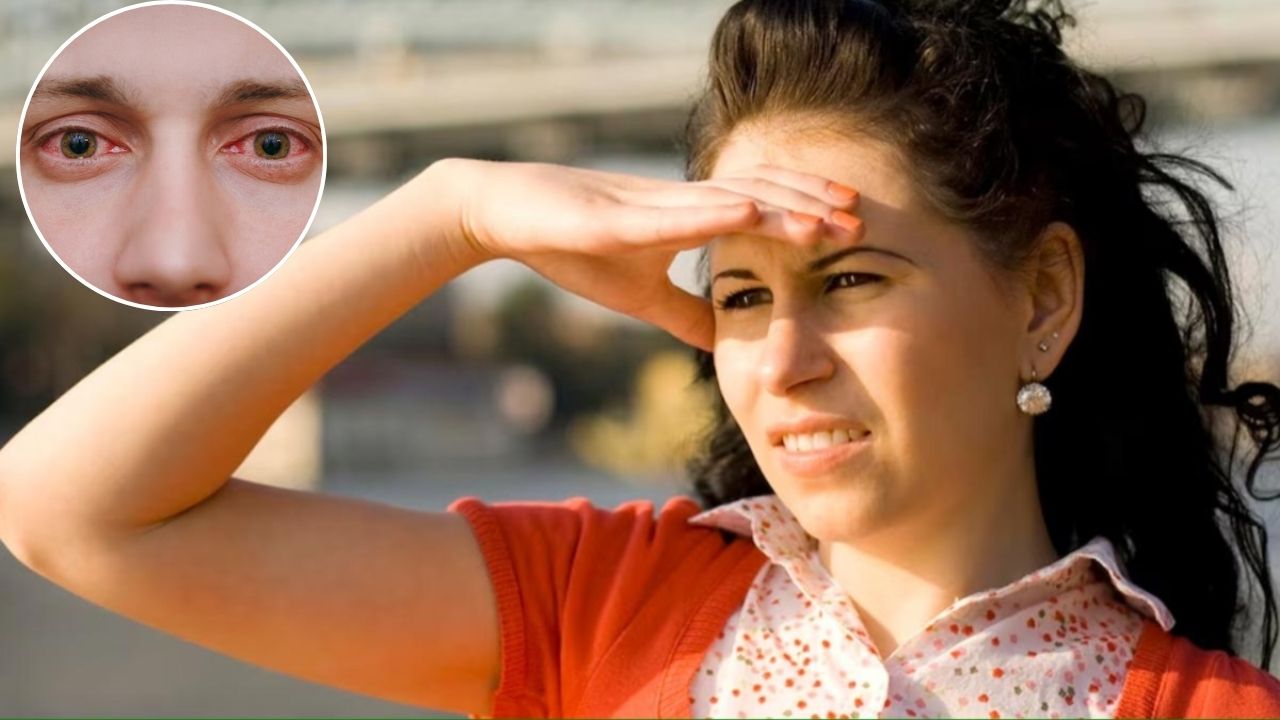 Eye Care Tips: अगर गर्मी में लाल हो रही हैं आंखें…तो हो जाएं सावधान, इस एक लापरवाही से हो सकता है इन्फेक्शन