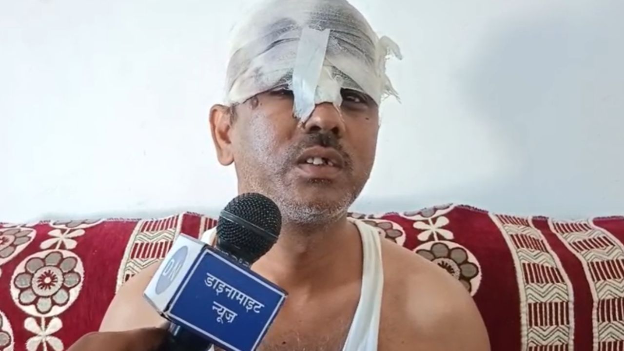 व्यापारी से दिनदहाड़े लूट मामले में डाइनामाइट न्यूज पर पीड़ित ने खोले वारदात के राज