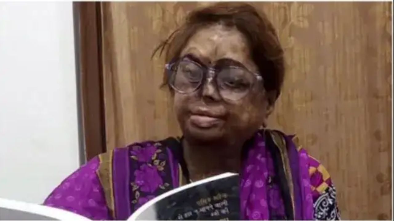 कौन हैं एसिड सर्वाइवर डॉ. मंगला कपूर? 36 सर्जरी का दर्द झेलकर हासिल किया पद्मश्री सम्मान