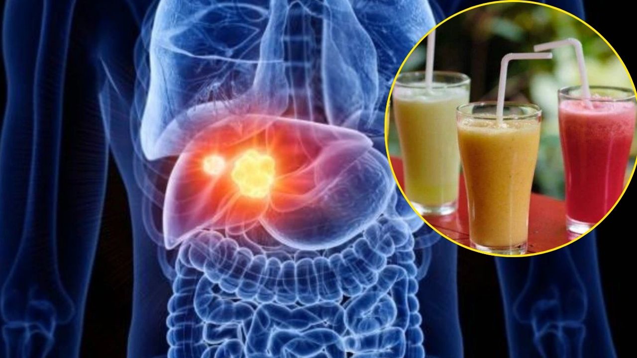 Fatty Liver को ठीक करने वाली ये 5 ड्रिंक्स… क्या सच में बदल सकती हैं आपकी सेहत?