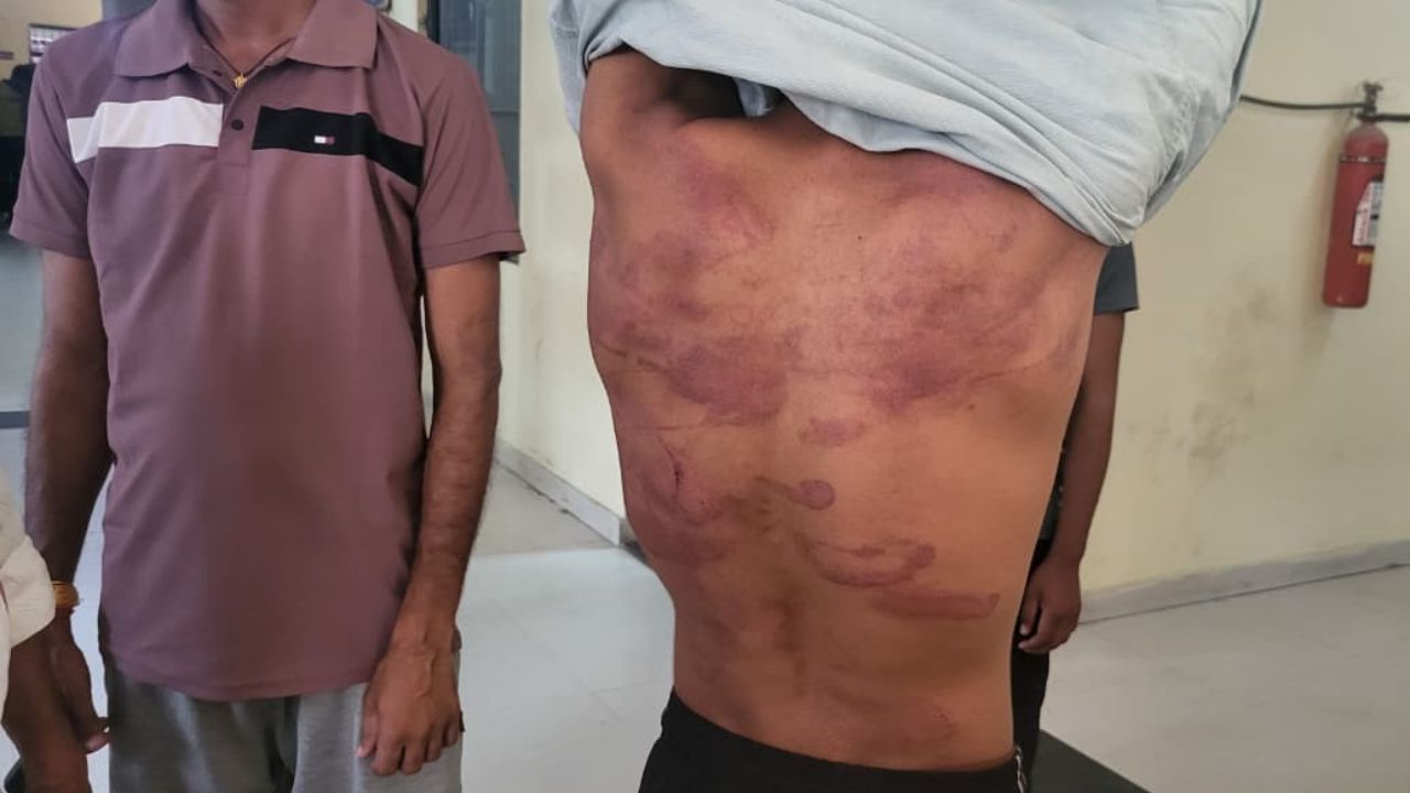 खेलते युवक को खेत में खींचकर पीटा, भागते ही चली गोली; तीन गिरफ्तार, एक फरार