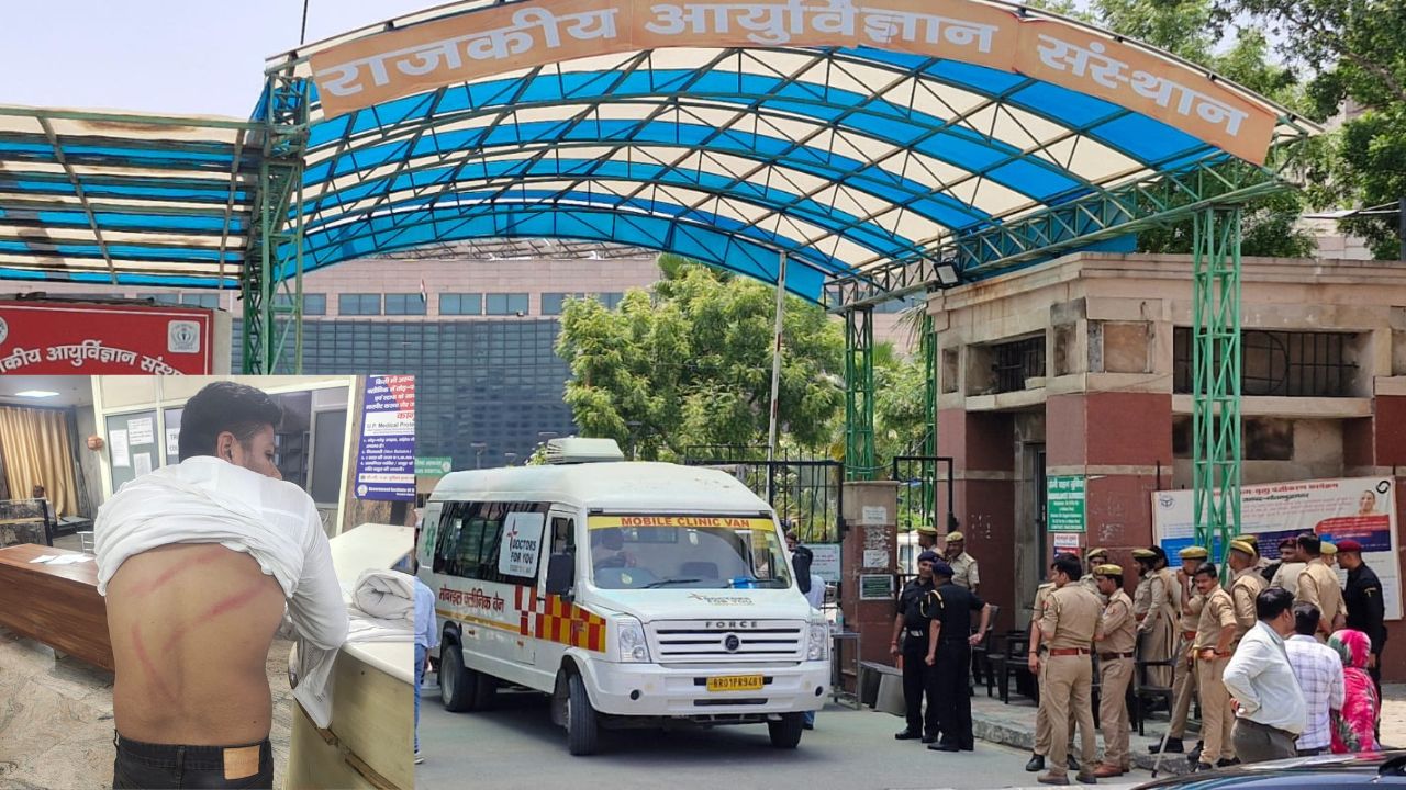 DN EXCLUSIVE: GIMS में धरना, पुलिस एक्शन और लाठीचार्ज के आरोप, जानें पूरी कहानी