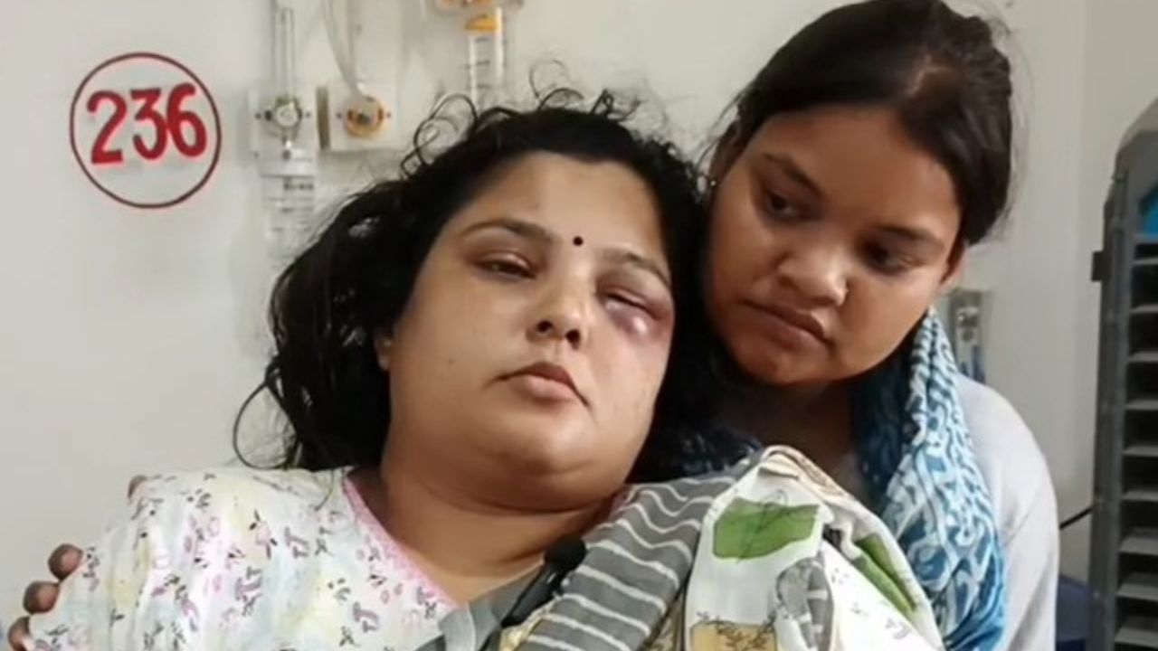 सपा की अंदरूनी कलह सड़क पर, गार्गी सिंह पटेल ने पूर्व प्रधान पर लगाया जानलेवा हमले का आरोप; दोनों पक्षों ने दी तहरीर