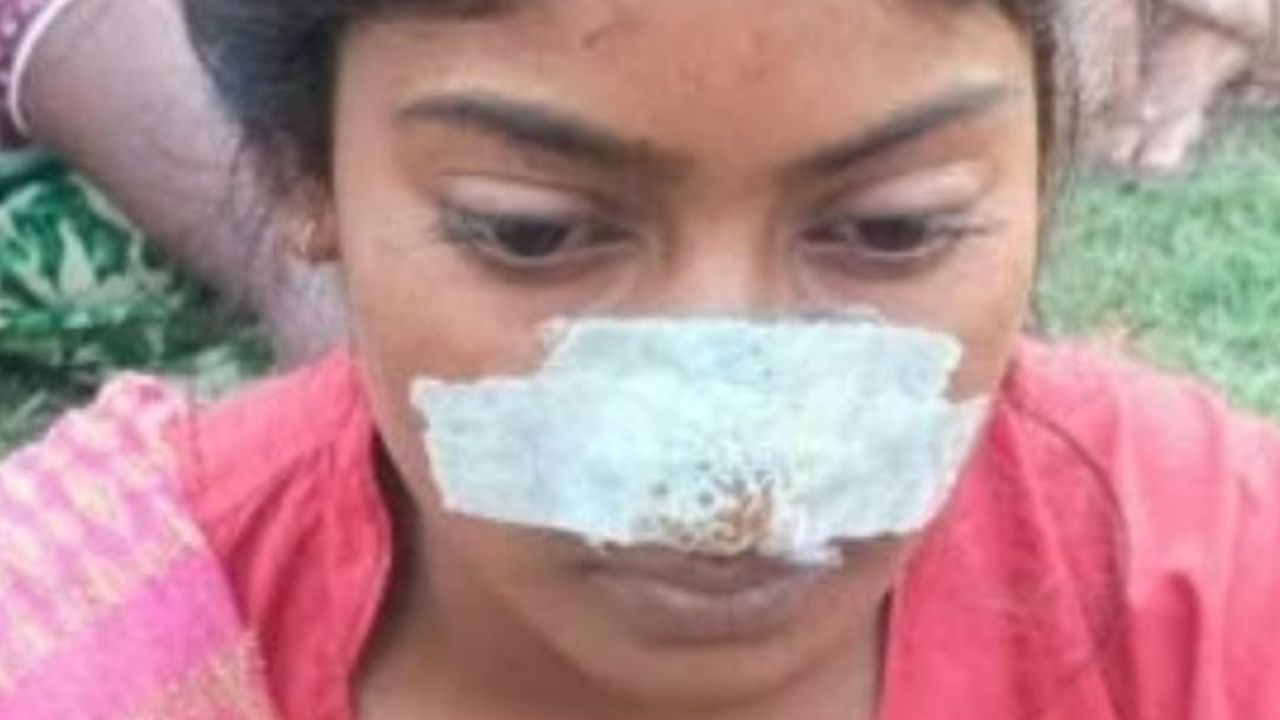 पत्नी की नाक काटने के बाद ससुर ने भी लिया बदला, लखीमपुर में हैरान करने वाला मामला