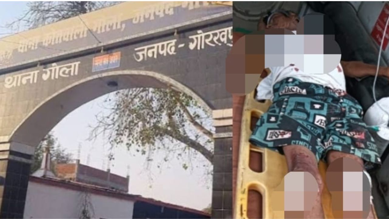 Gorakhpur: घर से निकला था रोज की तरह, उदईपुर मोड़ पर एक टक्कर ने जिंदगी बदल दी