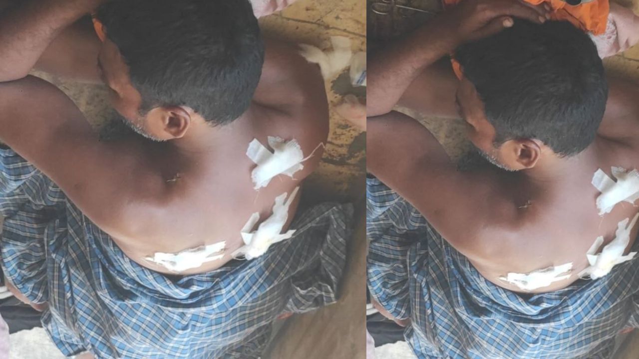1500 में मिठाई का सौदा, 100 रुपये एडवांस… फिर सुनसान जगह बुलाकर हलवाई पर चाकू से हमला