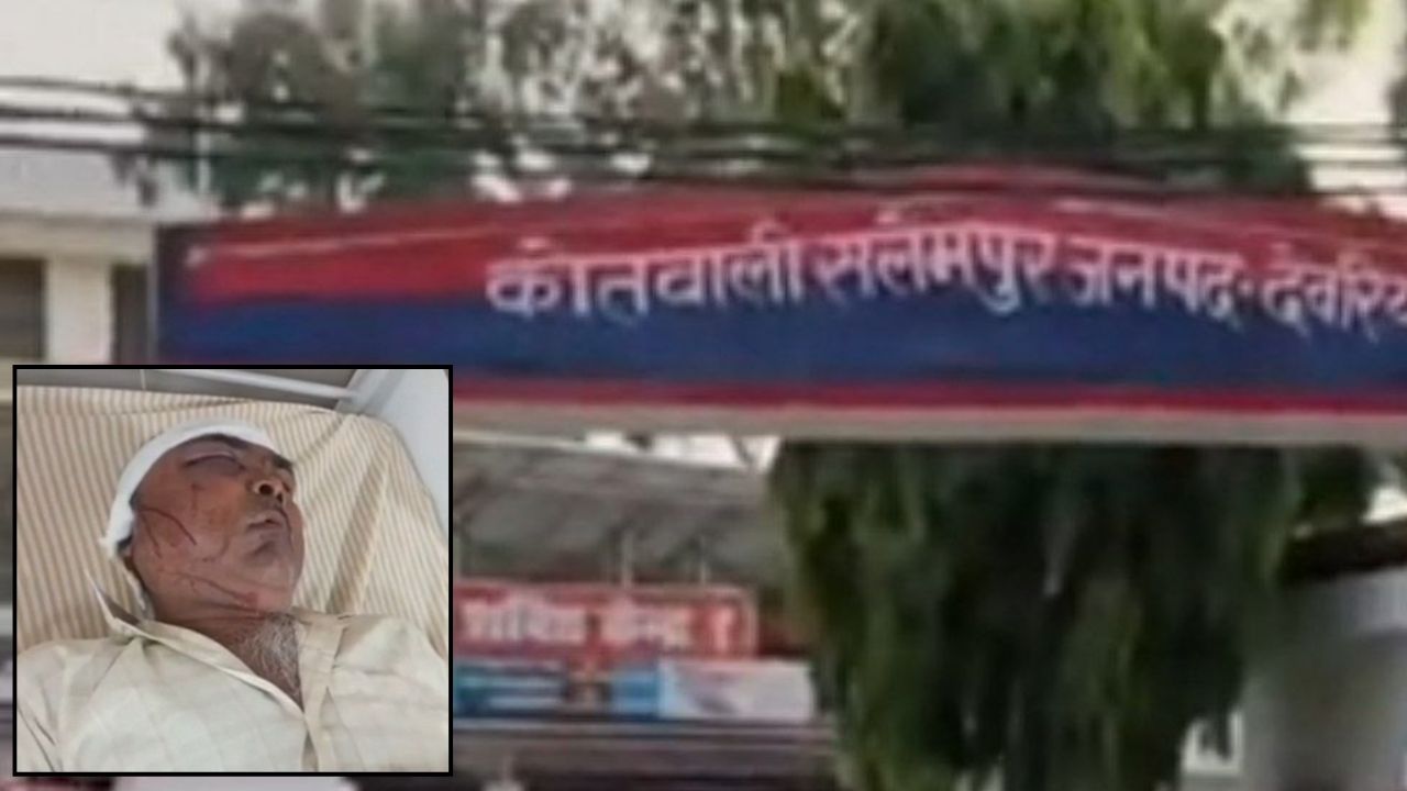 Deoria News: सोते हुए पिता पर कुल्हाड़ी से हमला, बचाने दौड़ी मां और भाई भी बने निशाना
