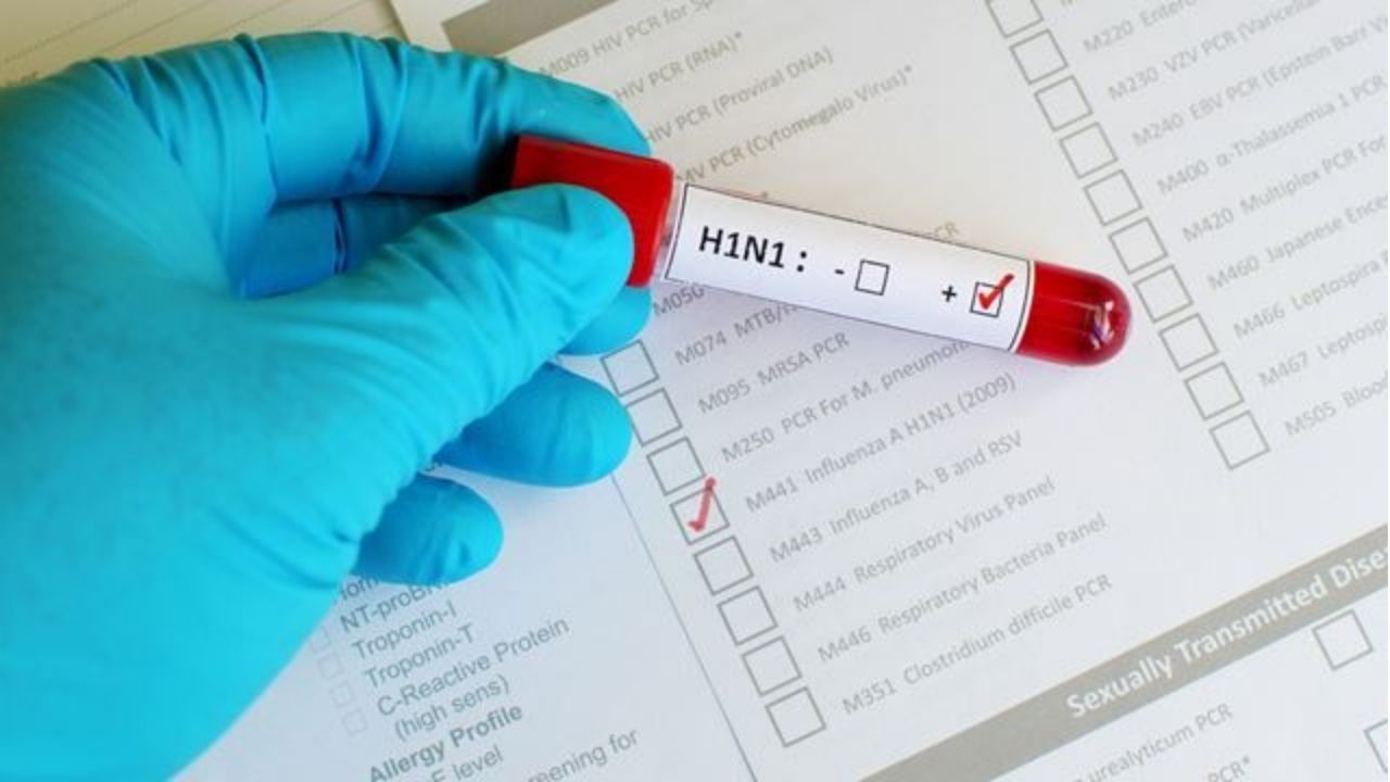 मासूम तो जंग जीत गया… पर क्या हाथरस बच पाएगा? सिकंदराराऊ में H1N1 की डरावनी वापसी से सहमे लोग