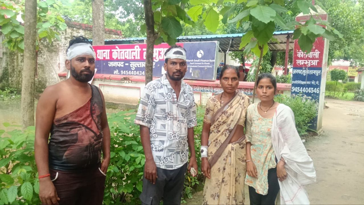 बस इतना सा था कसूर… सुलतानपुर में बहन का बचाव करने पर दबंगों ने लाठियों से बोला धावा, मचा हड़कंप