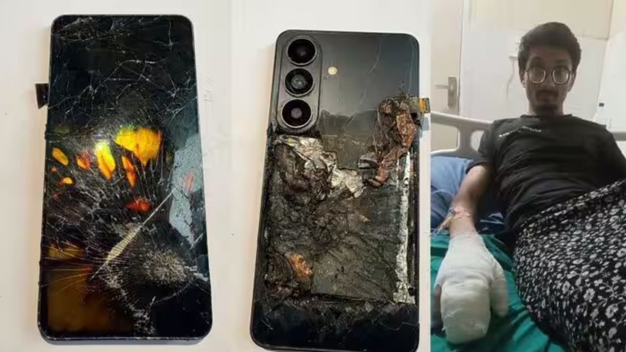 क्या आप भी करते हो Samsung Mobile का इस्तेमाल? पढ़ लें ये रौंगटे खड़े करने वाली खबर, इस फोन से ग्रेटर नोएडा का युवक पहुंचा अस्पताल