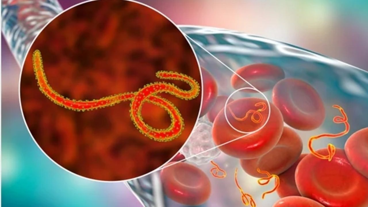 Ebola Virus Alert: यूपी में इबोला का केस नहीं, कांगो से लौटे आगरा के दो युवकों को निगरानी में रखा गया