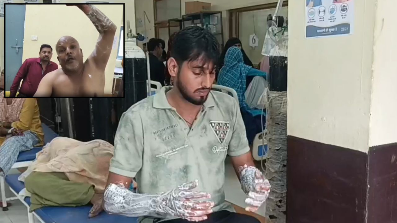 Hathras News: ग्राहकों के लिए शुरू हुई कहासुनी, हाथापाई तक पहुंची बात; फिर गर्म तेल की कढ़ाई में गिरे दोनों दुकानदार