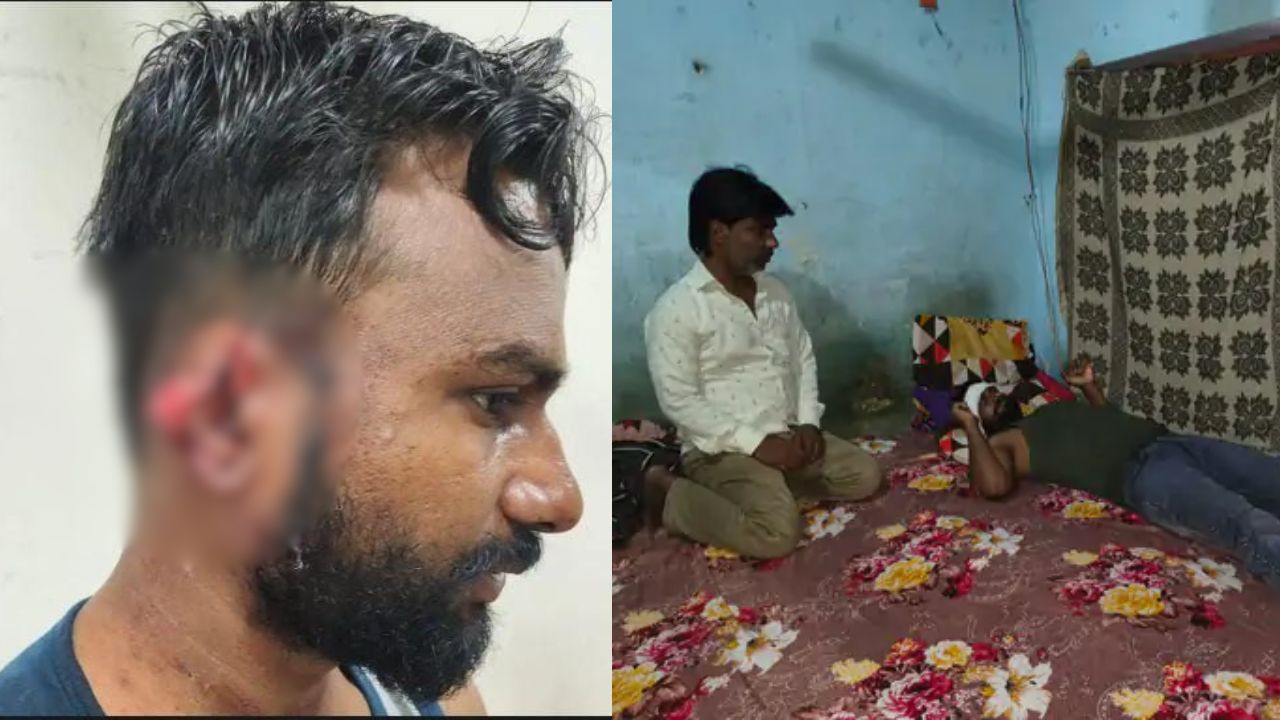मामूली विवाद में चाकू लेकर टूट पड़े नशे में धुत युवक, सब्जी दुकानदार का कान काटकर किया अलग; तीन पर केस
