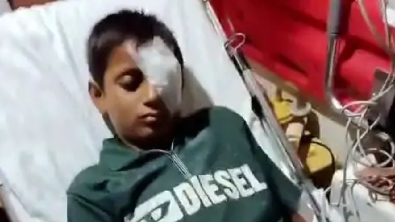इतनी सी बात पर 8वीं क्लास के छात्र की फोड़ी आंख, ग्रेटर नोएडा में स्कूल बना जंग का अखाडा