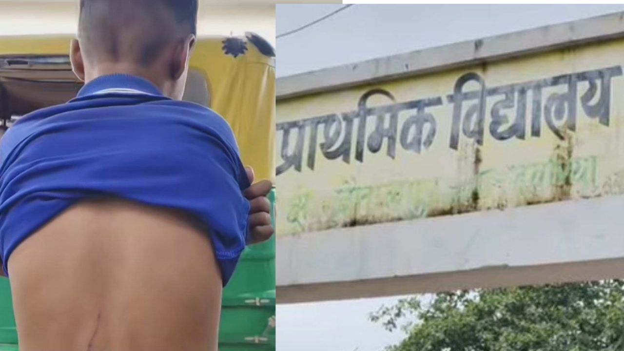 देवरिया में कक्षा 2 के छात्र को टीचर ने पीटा, पिता बोले- बेटा अब स्कूल जाने से डर रहा