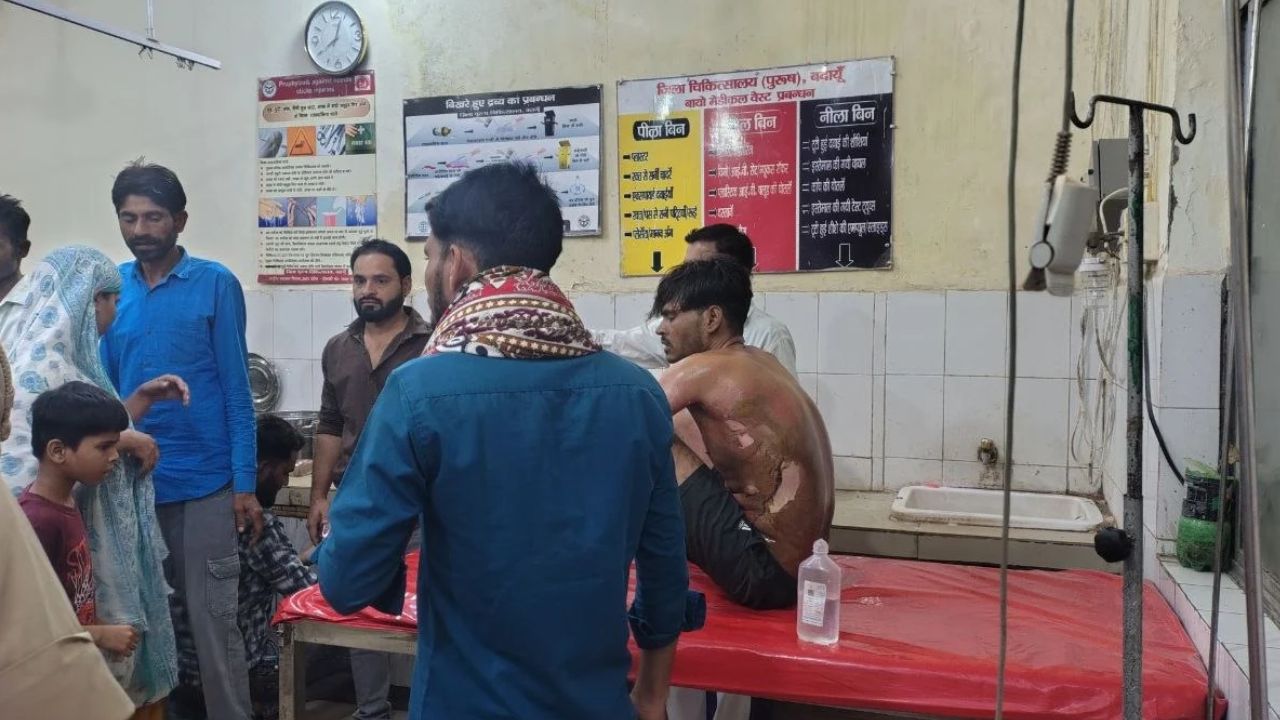 Budaun News: जलते चूल्हे में बच्चे ने डाल दी पेट्रोल की बोतल, आग की चपेट में आया पिता