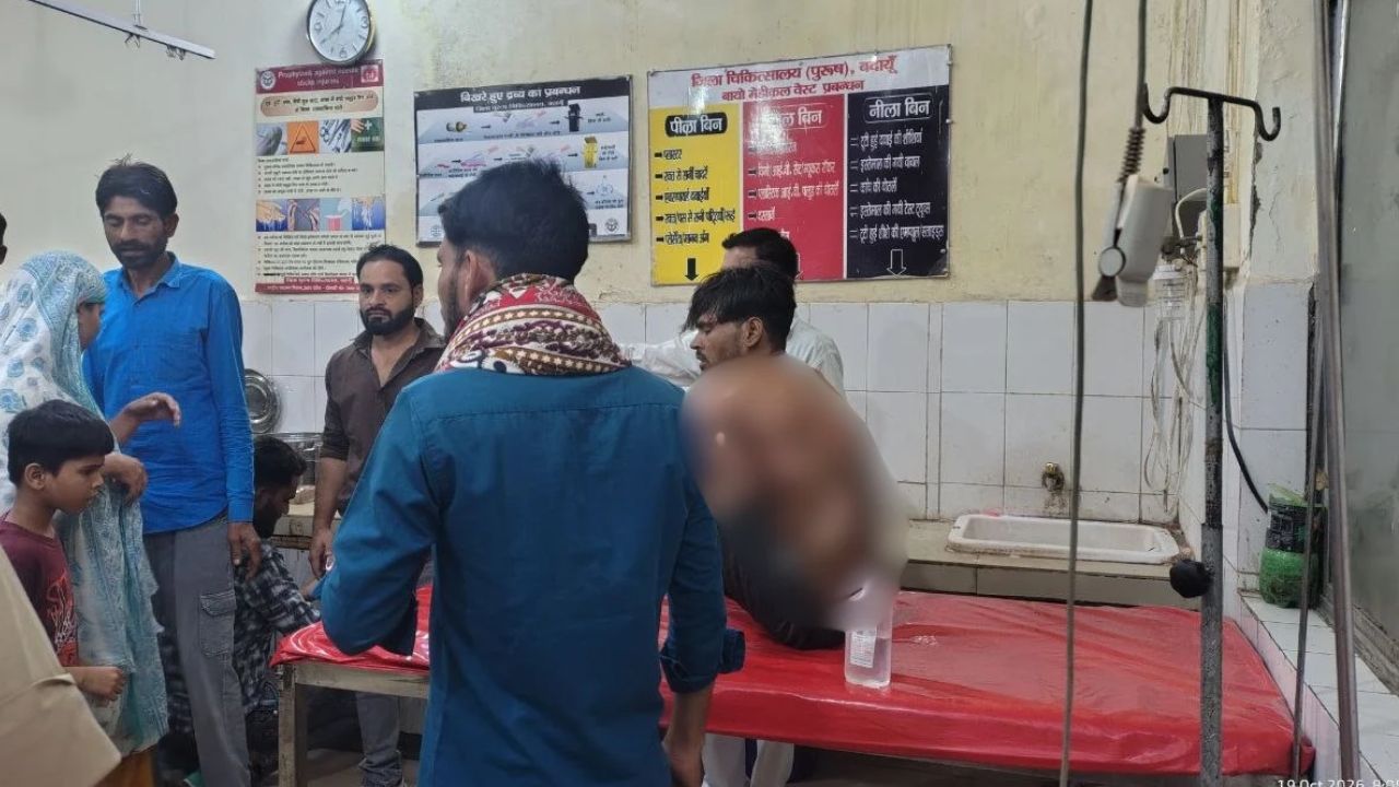 Budaun News: जलते चूल्हे में बच्चे ने डाल दी पेट्रोल की बोतल, आग की चपेट में आया पिता