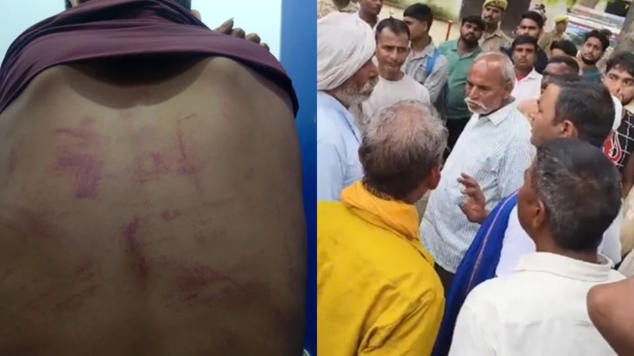 भाजपा विधायक के घर पिटाई का आरोप, 10 दिन से जांच ठप! दिल्ली में भर्ती रामू की हालत फिर बिगड़ी