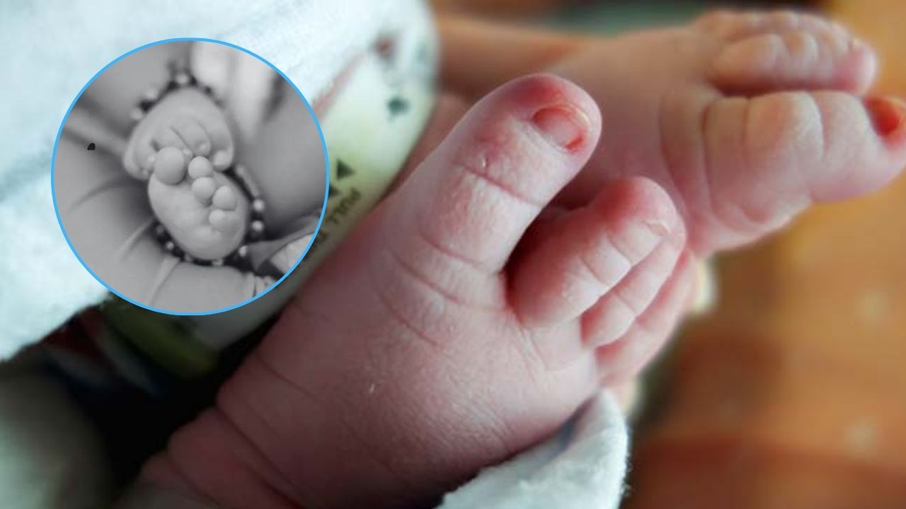 ओडिशा में 2 सिर वाले बच्चे का जन्म, मध्य प्रदेश में 4 हाथ-पैर वाला नवजात; क्या है इस दुर्लभ स्थिति की वजह?