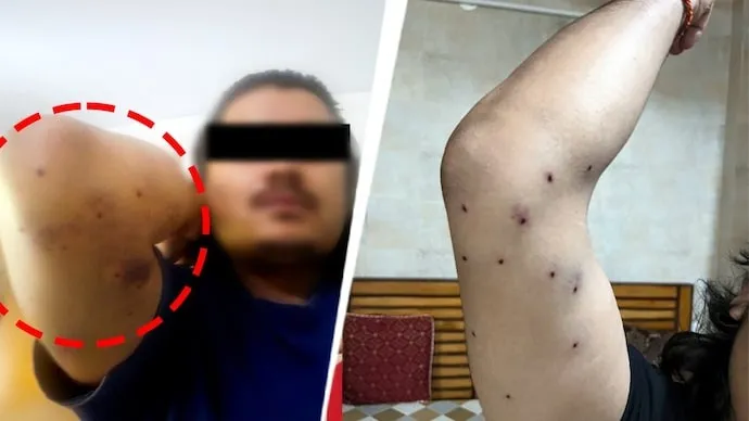 সিজেপি অভিযানের দিন পেলেট গুলিতে আহত ১০, আরটিআই জবাবে চাঞ্চল্য