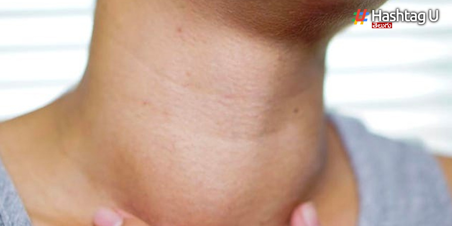 Throat
