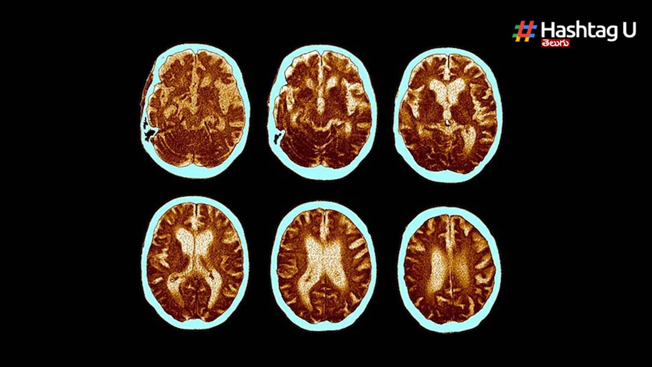 Brain