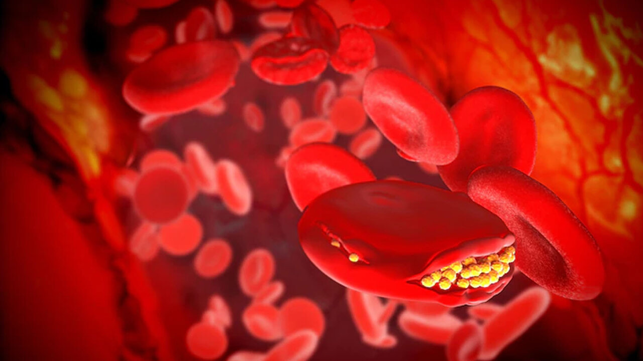 Cholesterol