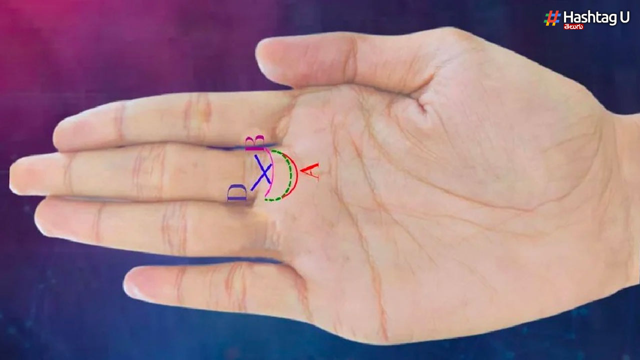 Hand